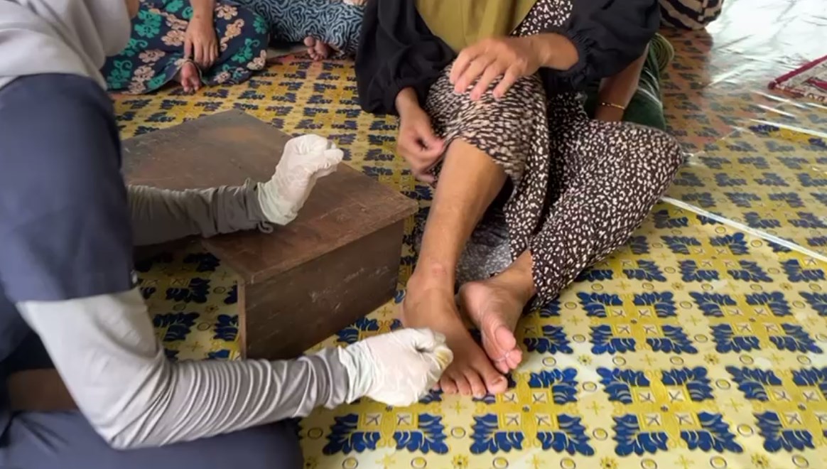 Warga Desa Pembantanan Keluhkan Penyakit Kulit